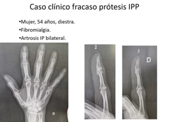 El Club: Sesión 32