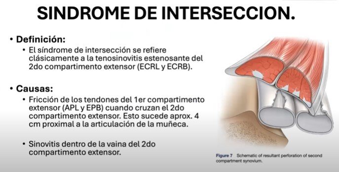 El Club: Sesión 30